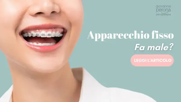 Sorriso con apparecchio fisso. Fa male togliere l'apparecchio fisso? Scopri di più leggendo l'articolo.