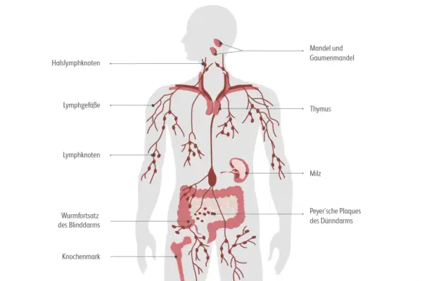 Das Lymphsystem mit Lymphknoten, Mandeln, Thymus, Milz und Darm. Mögliche Ursachen für Lymphom sind komplex und betreffen oft diese Organe.