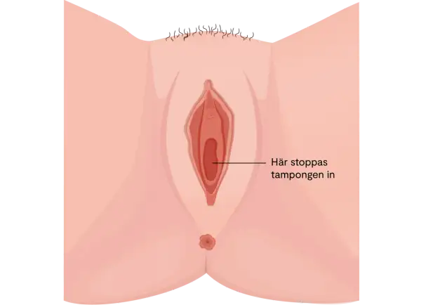 Illustration av en kvinnas underliv. En pil pekar in i vaginan med texten "Här stoppas tampongen in". Kan vara relevant vid diskussion om svamp i underlivet gravid.