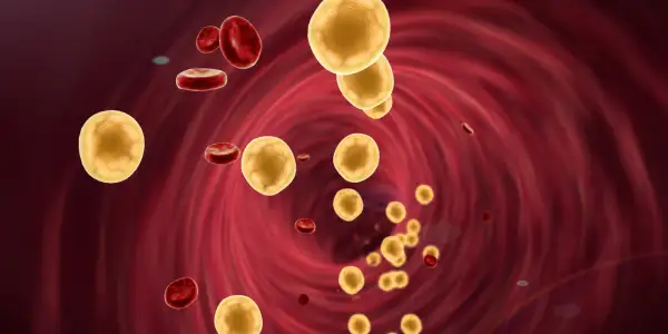 Jak obniżyć cholesterol na diecie keto? Skuteczne strategie i porady