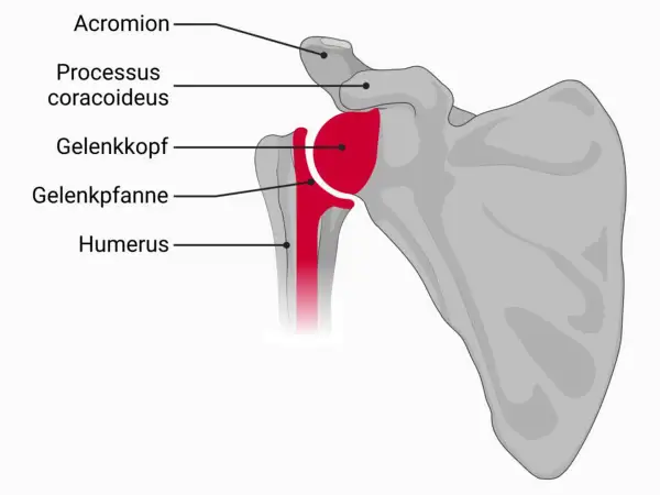 Anatomische Darstellung des Schultergelenks mit Humerus, Gelenkkopf, Gelenkpfanne, Acromion und Processus coracoideus. Eine inverse Schulterprothese ersetzt diese Strukturen.