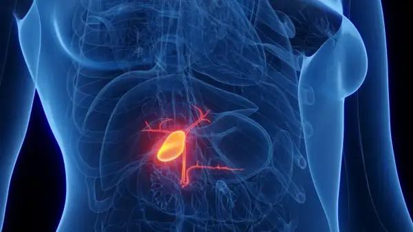 Anatomia woreczka żółciowego, gdzie czerwony obszar może symbolizować raka woreczka żółciowego i pytania o rokowania: rak woreczka żółciowego ile się żyje.