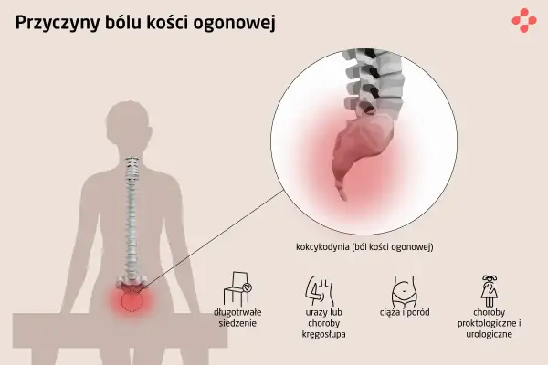 Ból kości ogonowej (kokcygodynia) może być spowodowany długotrwałym siedzeniem, urazami kręgosłupa, ciążą i porodem lub chorobami proktologicznymi.