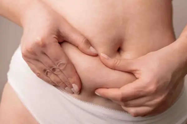 Mani che stringono la pelle dell'addome, mostrando la cellulite.