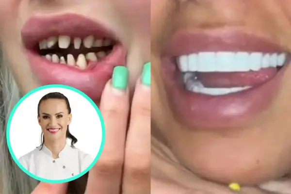 Przed i po: nieudane tureckie zęby, powikłania po zabiegu, a obok uśmiechnięta dentystka.
