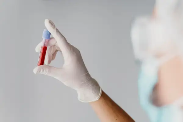 Ręka w białej rękawiczce trzyma probówkę z krwią do badań, np. mchc.