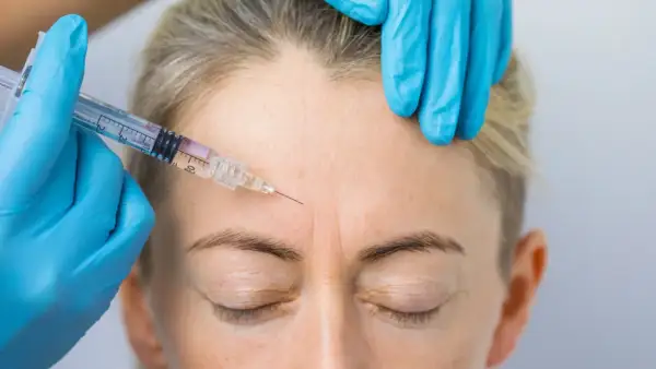 Zabieg baby botox na czole. Ręka w niebieskiej rękawiczce trzyma strzykawkę z igłą, która wstrzykuje preparat w zmarszczki mimiczne.