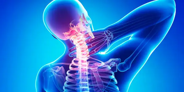 Menschlicher Nacken mit leuchtender Wirbelsäule, die auf Osteochondrosis intervertebralis hinweist.
