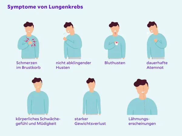 Symptome von Lungenkrebs: Schmerzen, Husten, Bluthusten, Atemnot, Schwäche, Gewichtsverlust, Lähmungen. Früherkennung ist wichtig für die Lebenserwartung.