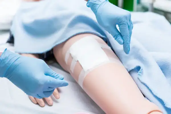 Ręce w niebieskich rękawiczkach zmieniają opatrunek na nodze, pokazując prawidłową pielęgnację rany pooperacyjnej w domu.