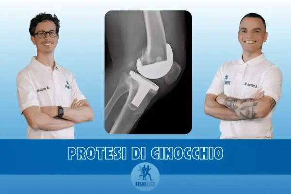 Due medici sorridono accanto a una radiografia di un ginocchio protesico, simbolo di recupero e miglioramento dei movimenti del polso.