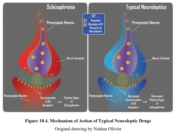 Schemat działania neuroleptyków: schizofrenia (nadaktywne receptory D2) vs. typowe neuroleptyki (blokada receptorów D2).