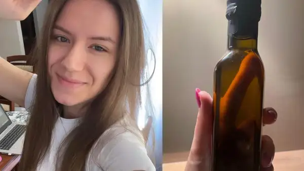 Uśmiechnięta dziewczyna i butelka z ciemnym płynem, prawdopodobnie olej z wiesiołka, który może pomóc w pielęgnacji.
