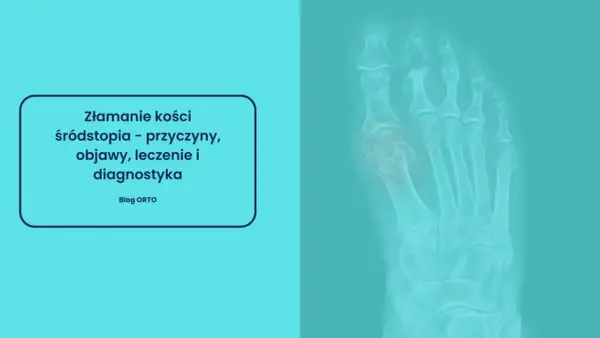Rentgen stopy z widocznym złamaniem kości śródstopia.