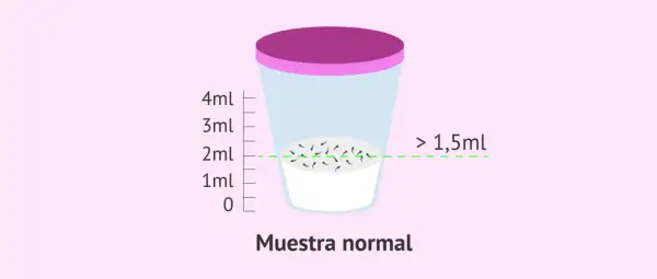 Recipiente con muestra de semen, indicando que la cantidad normal de espermatozoides en una eyaculación es mayor a 1,5ml.