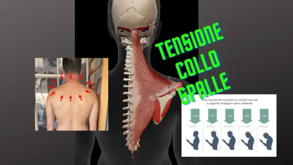Anatomia muscolare e scheletrica del collo e delle spalle, con frecce rosse che indicano punti di dolore e un grafico sulla tensione muscolare collo.