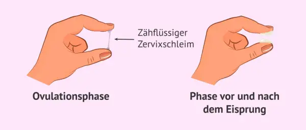 Hände zeigen Zervixschleim: zähflüssig in der Ovulationsphase, klumpig davor/danach. Ein Zeichen für Fruchtbarkeit bei Frauen.