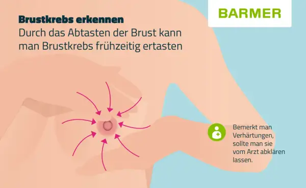 Brustkrebs erkennen: Pfeile zeigen auf eine Brustwarze, wo sich Knoten in der Brust befinden könnten. Bei Verhärtungen Arzt aufsuchen.