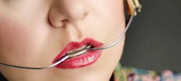 Labbra rosse con apparecchio ortodontico, un dettaglio del viso con un apparecchio baffo che si estende verso l'orecchio.