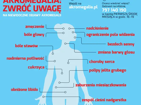 Akromegalia: zmęczenie, bóle głowy, stawów, nadciśnienie, problemy ze wzrokiem, bezdech senny, cukrzyca. Zwróć uwagę na te objawy!