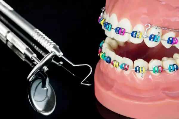 Kolorowy aparat ortodontyczny na modelach szczęk, symbolizujący korektę zgryzu krzyżowego przed i po. Obok narzędzia dentystyczne.
