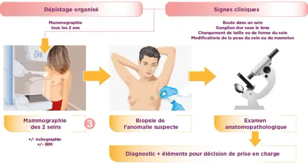 Un examen anatomopathologique suit une biopsie, étape clé pour le diagnostic.