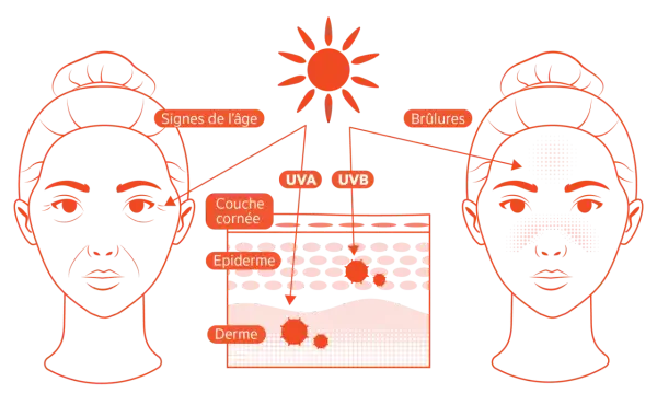 Illustration montrant les effets des rayons UVA et UVB sur la peau : vieillissement prématuré et coups de soleil.