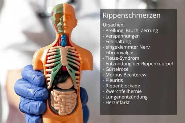 Anatomisches Modell zeigt Ursachen für Schmerzen Rippen links seitlich bei Bewegung, wie Prellung, Zerrung oder eingeklemmter Nerv.