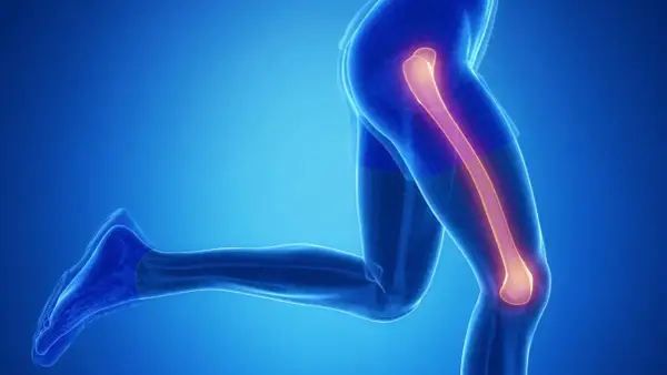 Anatomia nogi z podświetloną kością udową, sugerującą złamanie kości udowej.