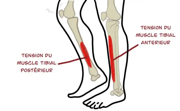 Schéma des muscles du tibia, montrant la tension du muscle tibial antérieur et postérieur, cause fréquente de mal au tibia.