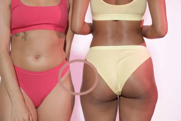 Deux femmes en sous-vêtements. La femme de droite, en jaune, montre des marques sur ses **hips dips**, une partie naturelle du corps.