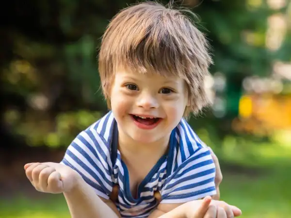 Un bambino sorridente con la sindrome di Down, con i suoi tratti distintivi, indossa una maglietta a righe blu e bianche.