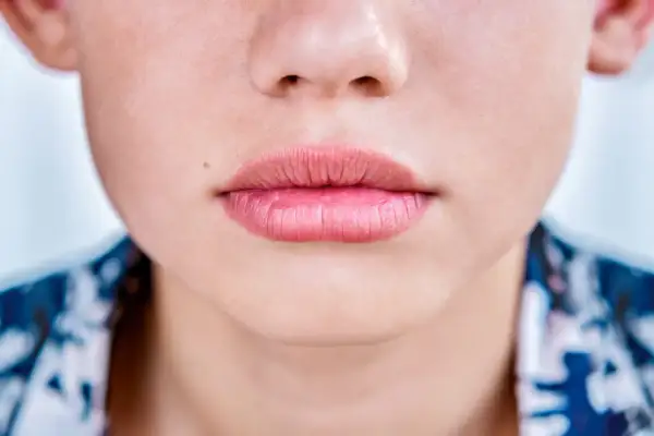 Gros plan sur une bouche aux lèvres légèrement gercées, d'une teinte rosée naturelle.