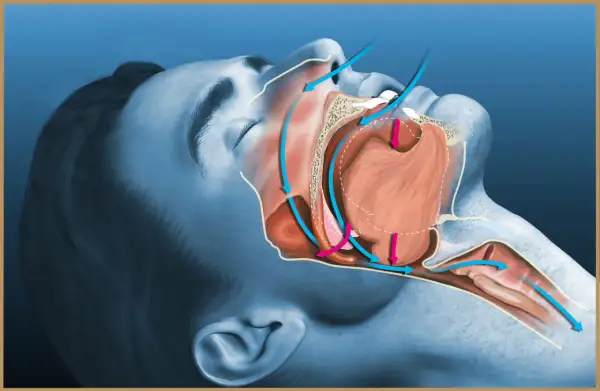 Anatomia snu: jak otworzyć drogi oddechowe i co zrobić żeby nie chrapać. Strzałki pokazują przepływ powietrza.