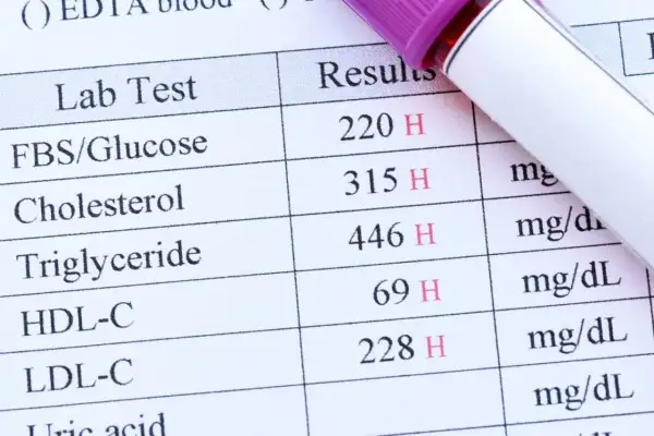 Résultats d'une prise de sang montrant des taux élevés de glucose, cholestérol et triglycérides. Une prise de sang sert à évaluer votre état de santé.