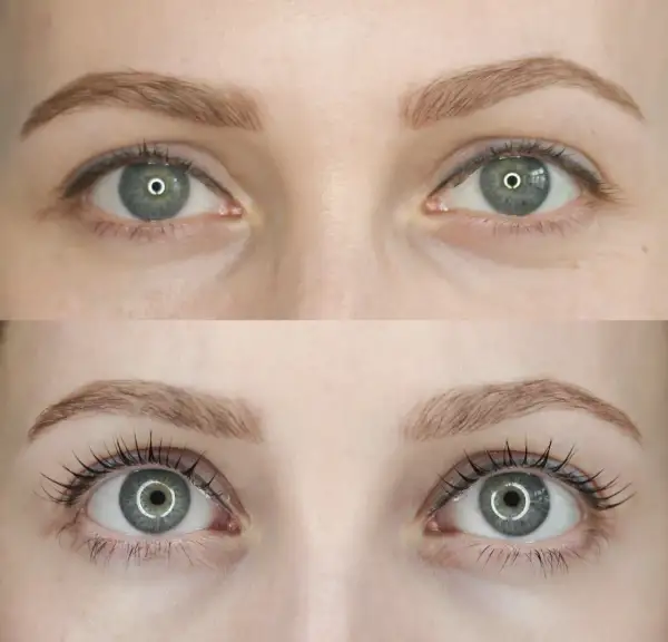 Botox rzęs co to jest: poznaj efekty i różnice z laminacją