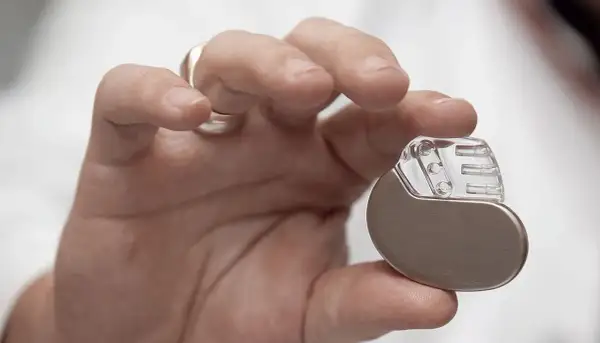 Dłoń trzymająca niewielki pacemaker. Dzięki niemu można wrócić do aktywności, nawet do biegania.