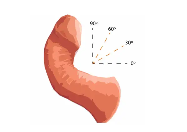 Ilustracja przedstawia wygląd penisa z zaznaczonymi kątami: 0°, 30°, 60° i 90°.
