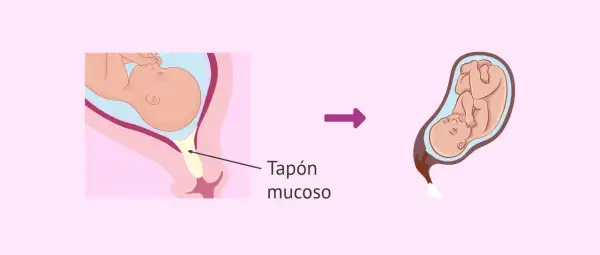 Ilustración muestra un bebé en el útero y el tapón mucoso, seguido de un bebé listo para nacer.