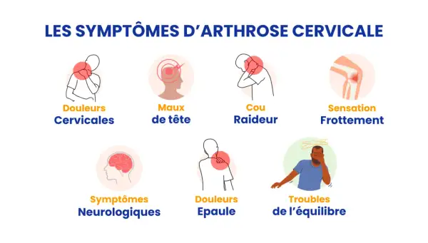 Illustrations des symptômes de l'arthrose cervicale : douleurs cervicales, maux de tête, cou raideur, sensation frottement, symptômes neurologiques, douleurs épaule, troubles équilibre.