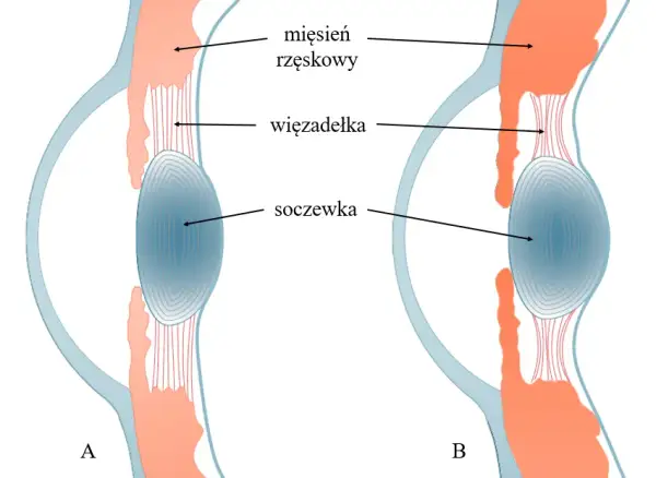 Jak działa soczewka oka i dlaczego ma kluczowe znaczenie dla wzroku