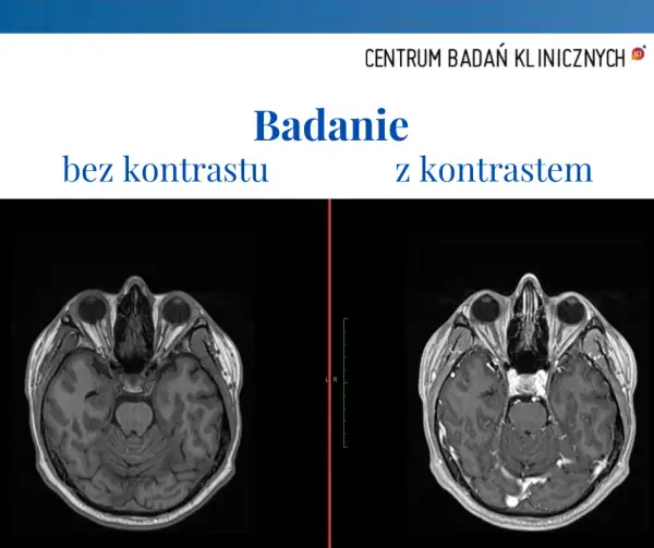 Alkohol po kontraście: czy można pić i jakie są zagrożenia?