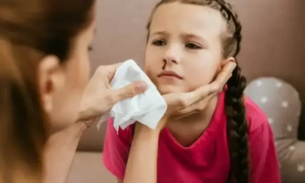 Dlaczego dziecku leci krew z nosa? Przyczyny i sposoby pomocy rodzicom