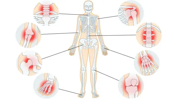 Menschliches Skelett mit hervorgehobenen Gelenken, die Schmerzen zeigen. Arthrose heilen ist so einfach, wenn man die betroffenen Stellen kennt.