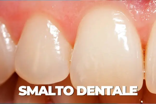 Primo piano di denti sani, con smalto lucido e gengive rosa. Un esempio di smalto dentale forte, pronto per la remineralizzazione.
