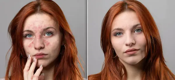 Jak skutecznie zmienić bladą cerę na zdrową i promienną?