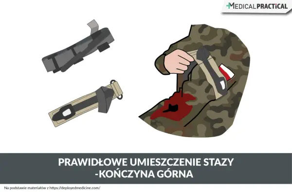 Ilustracja pokazuje, jak prawidłowo założyć stazę na kończynę górną żołnierza z raną.