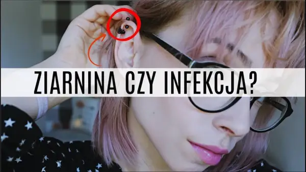 Jak skutecznie leczyć ziarninę po piercingu i uniknąć powikłań