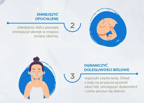 Jak pozbyć się pryszcza w kilka godzin? Chłodzenie skóry zmniejsza opuchliznę, a okład z lodu łagodzi ból.