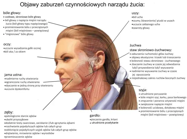 Ból żuchwy, głowy, uszu, oczu, gardła, szyi, zębów i jamy ustnej. Ilustracja przedstawia objawy zaburzeń narządu żucia.